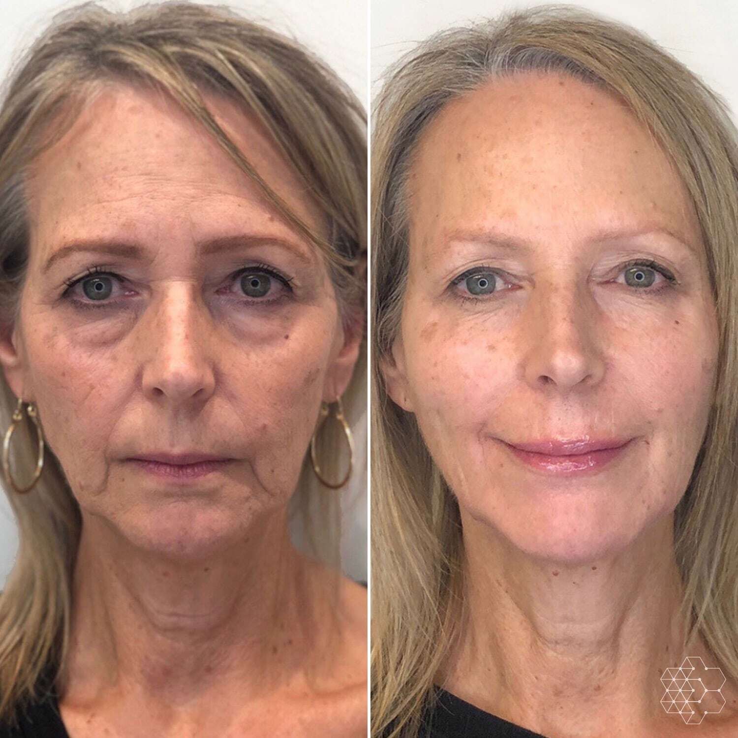 The Anti-Aging Peptide Discovered in Young Blood. Now in a Bottle.