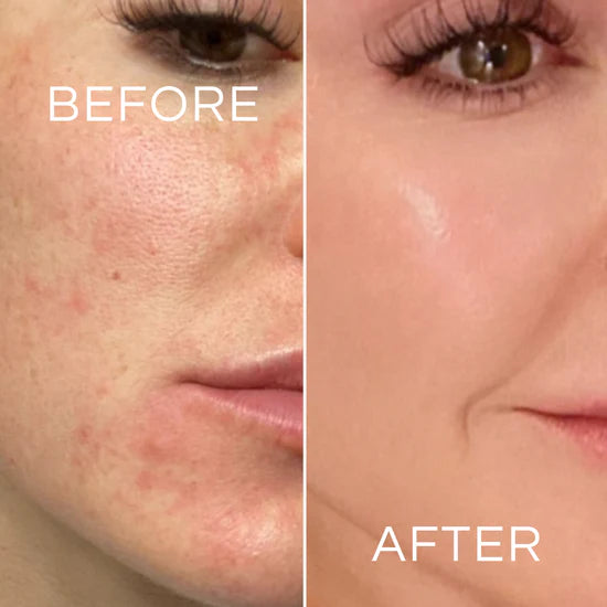 The Anti-Aging Peptide Discovered in Young Blood. Now in a Bottle.