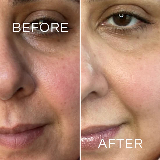 The Anti-Aging Peptide Discovered in Young Blood. Now in a Bottle.